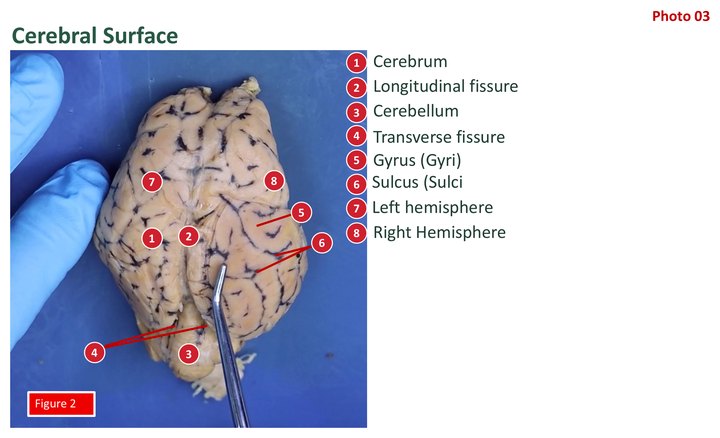 Labeled dorsal view of a sheep brain. A numbered key identifies the cerebrum, hemispheres, fissures, a gyrus, a sulcus, and the cerebellum.