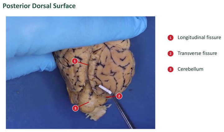 Labeled posterior dorsal view of a sheep brain, with a numbered key for the longitudinal fissure, transverse fissure, and cerebellum.