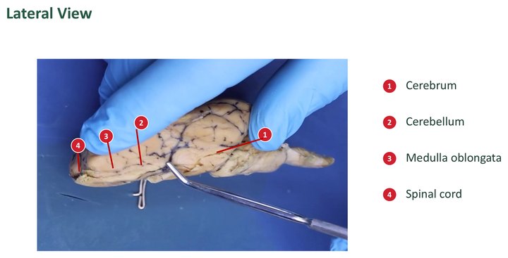 Labeled side view of a sheep brain held in a gloved hand, with a numbered key for the cerebrum, cerebellum, medulla oblongata, and spinal cord.