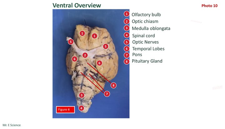 Labeled ventral view of a sheep brain. A numbered key identifies the olfactory bulbs, optic chiasm, optic nerves, temporal lobes, pituitary gland, pons, medulla oblongata, and spinal cord.