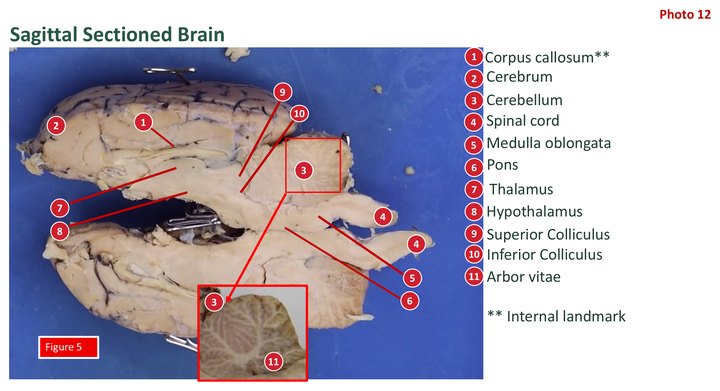 Labeled midsagittal section of a sheep brain, with a numbered key and an inset of the arbor vitae in the cerebellum.
