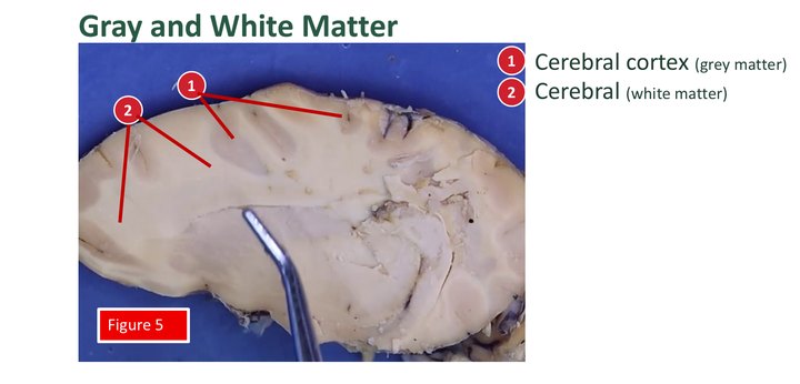 Labeled close view of a sectioned sheep cerebrum, with a numbered key for the cerebral cortex and the white matter beneath it.