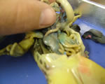 large intestine