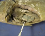 Stomach