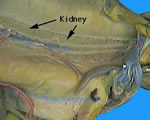 Internal-Kidney