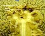 Madreporite - Stone Canal-Ring Canal- Radial canal-ampulla