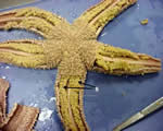 Pyloric Cecum